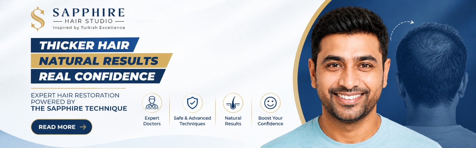 Thicker hair, natural results, real confidence — expert hair restoration powered by the Sapphire technique