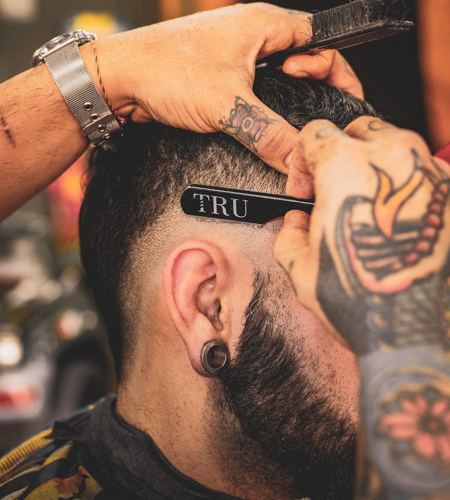 Hair Transplant