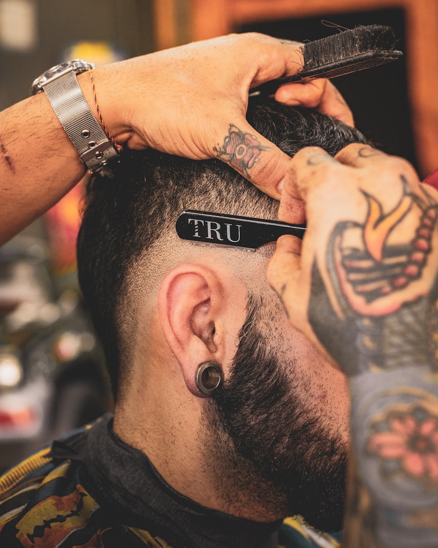 Hair Transplant